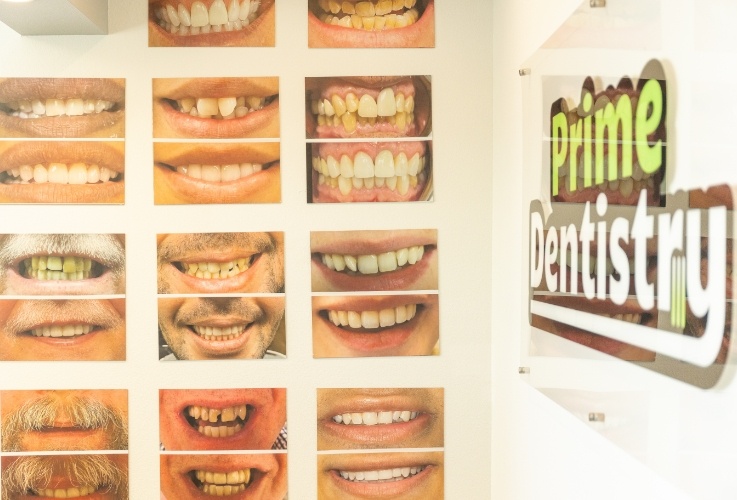 Wall at Prime Dentistry covered with before and after photos of smiles
